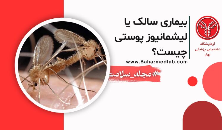 بیماری سالک یا لیشمانیوز پوستی(Leishmaniasis )